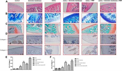 Effect of Amniotic Membrane/Collagen-Based Scaffolds on the Chondrogenic Differentiation of Adipose-Derived Stem Cells and Cartilage Repair